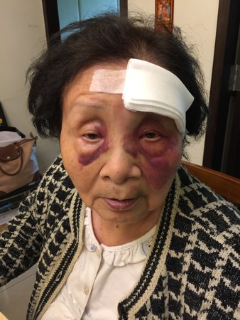 IM体育-包含老妇人球员因伤缺席下一场比赛的词条